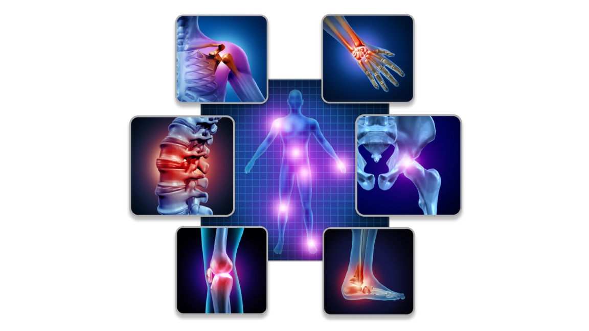 Fibromialgia