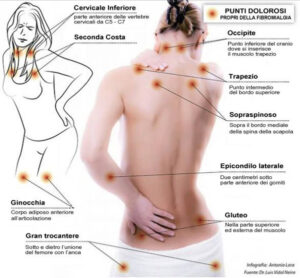 Fibro